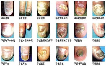 ����<a href='http://4g.cqpfk.net/yyjs/index.html' target='_blank' title='������'><span style='color: #0000ff'><strong>������</strong></span></a>ҽԺ���ƻ�ָ��